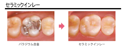 審美歯科8