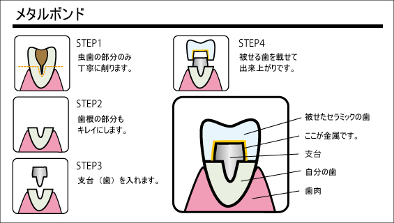 審美歯科10