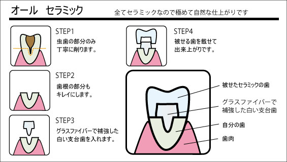 審美歯科9